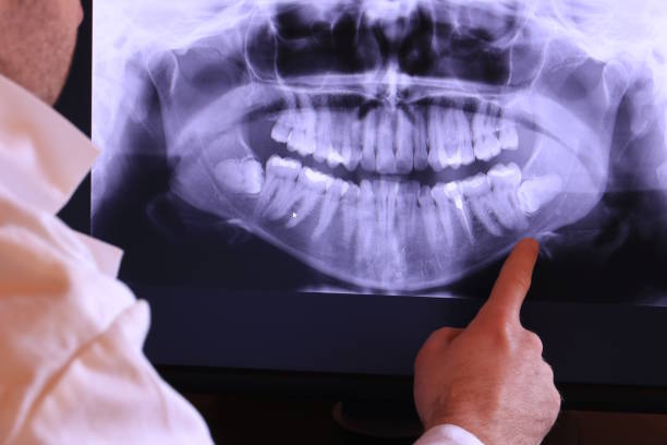 Best Emergency Tooth Extraction in Harrison, OH