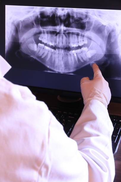 Best Emergency Treatment for Toothache in Harrison, OH